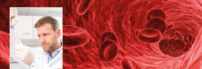 Clinical Applications: Offering high-end analytical measuring technology, modern kits and assays Analytik Jena covers the needs of a wide range of clinical applications.